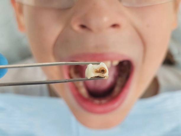 Best Cracked Tooth Emergency Dentist  in Pis, AR